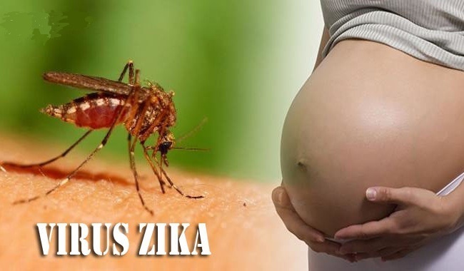 Thai phụ cần làm gì khi dịch Zika bùng phát?