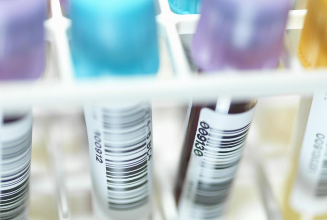 Phát triển thuốc có thể chữa khỏi HIV và AIDS