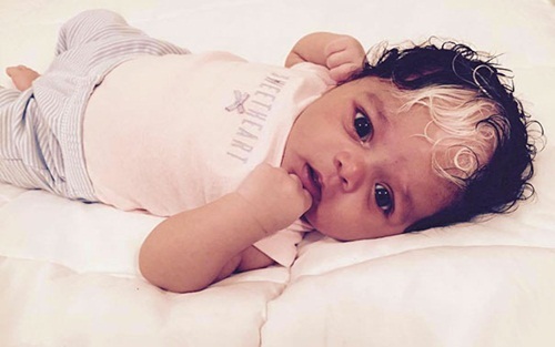 Kỳ lạ em bé sinh ra với hai màu tóc, hai màu da