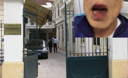 Vụ tiến sĩ 76 tuổi bị đánh: Công an chờ kết quả giám định để xử lý