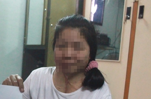 Gia cảnh khốn cùng của người phụ nữ vá xe bỗng dưng bị tạt a-xít