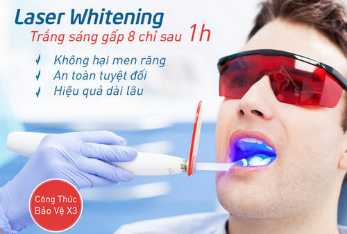 Giải đáp nhanh câu hỏi: Làm trắng răng có đau không?