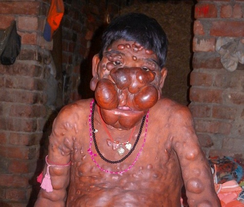 Chàng trai bị gọi là