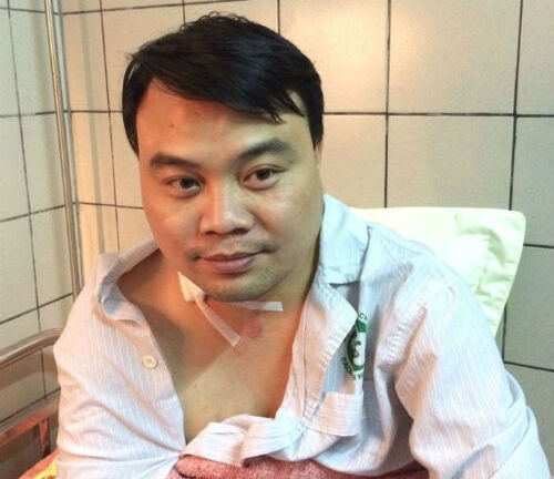 Chiếc vòng cổ cứu mạng trưởng CA phường trong tình thế nguy cấp