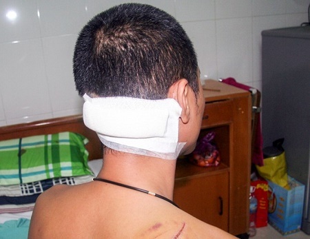 Nhóm côn đồ hung hãn xông vào quán nhậu 