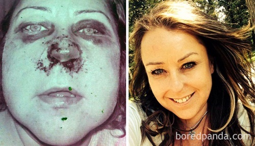 Ngạc nhiên với loạt hình ảnh trước và sau khi bỏ thuốc