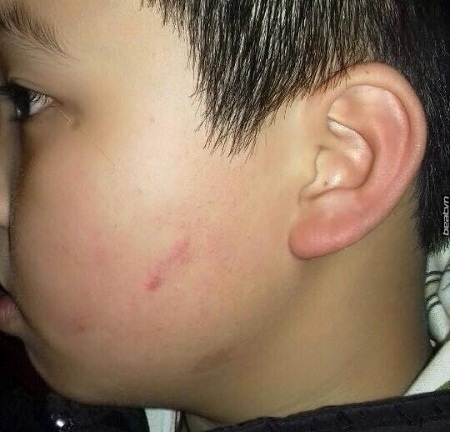 Học sinh nói bậy, cô giáo cho 43 học sinh khác tát vào mặt bạn