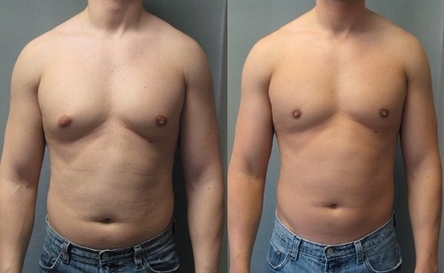 Những bộ phận dù vô dụng nhưng vẫn xuất hiện trên cơ thể con người