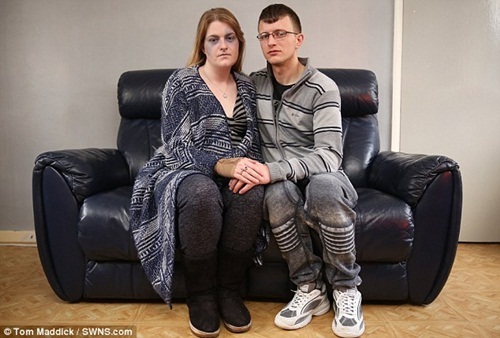 Mắc chứng bệnh lạ cô gái bị nhầm tưởng là nạn nhân của bạo hành