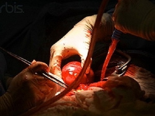 Bật mí về 6 trường hợp sử dụng cơ thể của người hiến xác