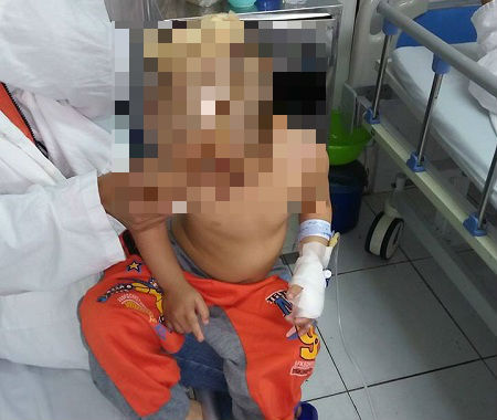 Bé gái  3 tuổi suýt mất mạng vì bị chó hoang tấn công