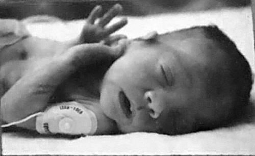 14 tuổi mới biết mình là đứa trẻ sống sót sau một vụ phá thai