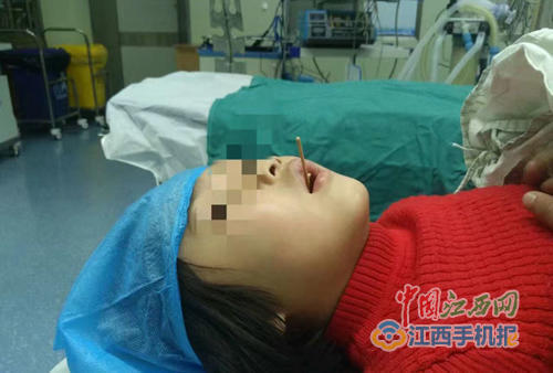 Cứu sống bé gái bị que xiên đâm xuyên cổ họng khi ăn xúc xích