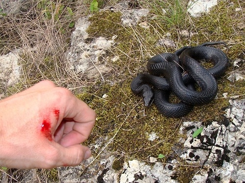 6 kỹ năng sơ cứu cơ bản để bạn xử lý 6 tình huống nguy hiểm trong cuộc sống