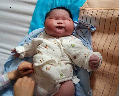 Bé sơ sinh 7kg khiến các bác sĩ ngỡ ngàng