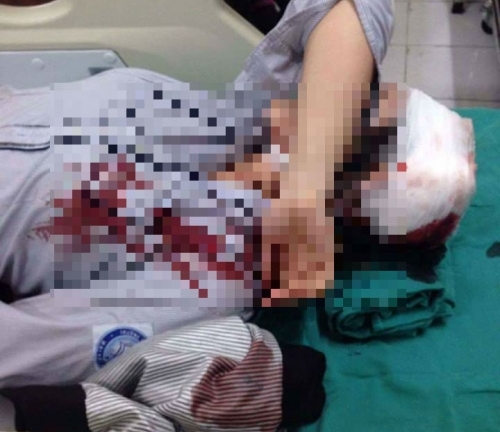 Bị bạn đánh vào đầu, nữ sinh Hà Nội nhập viện cấp cứu