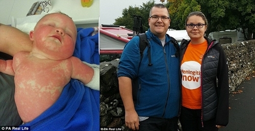 Bản năng của người mẹ cứu mạng con gái bị bác sĩ chẩn đoán nhầm mắc thủy đậu