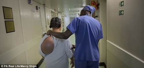 Bị gọi là ‘quái vật’ vì khối u không ngừng phát triển trên lưng suốt 4 thập niên