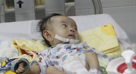 Phẫu thuật cho bé gái Sóc Trăng bị dị tật tim hiếm gặp trên thế giới