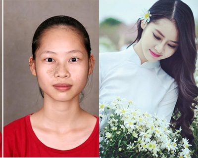 Nữ sinh sư phạm từng mặc cảm với gương mặt xấu xí bỗng 'lột xác' hóa 'thiên nga'
