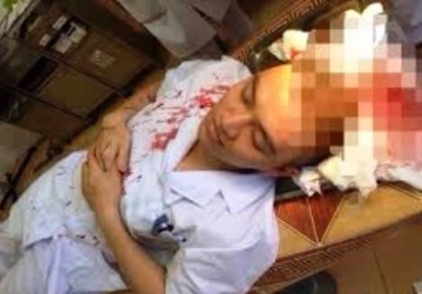 Bố bệnh nhi ném cốc thủy tinh làm Phó khoa chảy máu ròng ròng bị tạm giữ