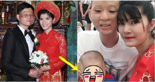 Khoe ảnh cận mặt con trai, cặp chồng xấu vợ xinh khiến dân mạng sốc