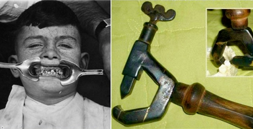 Những thiết bị nha khoa thời “ông bà anh” khiến bạn khóc thét khi nhìn thấy