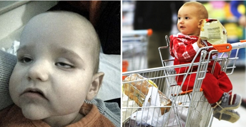 Ngồi trên xe đẩy hàng siêu thị, sau 24 giờ bé trai bị viêm màng não