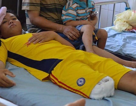 Đình chỉ kíp trực khiến bé trai 16 tuổi phải cắt chân oan uổng