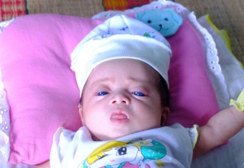 Cô bé người Việt có mắt xanh kỳ lạ