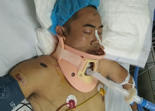 Mẹ nghèo nghẹn đắng nhìn con hôn mê mà bất lực