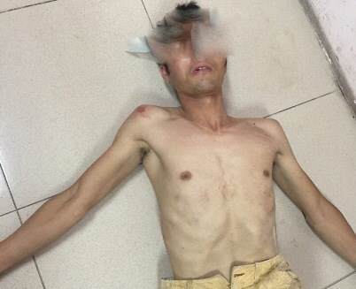 Hà Nội: Giải cứu cô gái trẻ bị đối tượng lạ mặt bắt trói, đe dọa trong nhà nghỉ