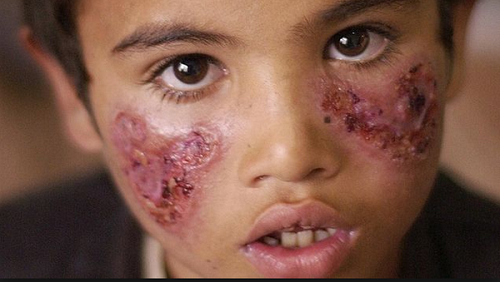 Con muỗi bé xíu nhưng lại là sát thủ giết người nhiều nhất mỗi năm