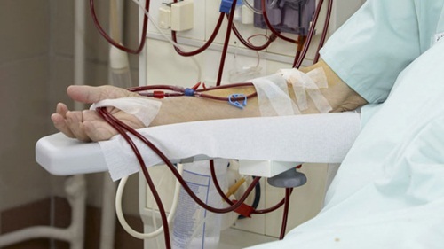 Chạy thận nhân tạo: Những biến chứng và tác dụng phụ nguy hiểm