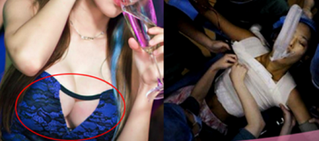 Cô gái 23 tuổi bất ngờ nổ tung ngực khi đang nhảy tại hộp đêm