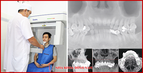 Nha Khoa Đông Nam Ra Mắt cơ sở 2 Tại TP. Hồ Chí Minh