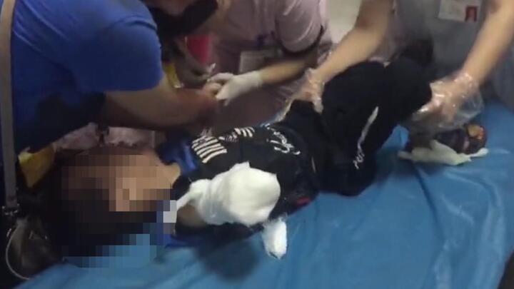 Cậu bé Trung Quốc bị thang cuốn nghiến đứt cánh tay