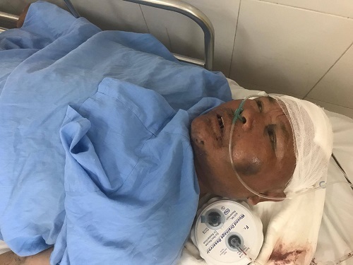 Tìm người nhà bệnh nhân bị xe máy đâm chấn thương sọ não đang ở BV Việt Đức