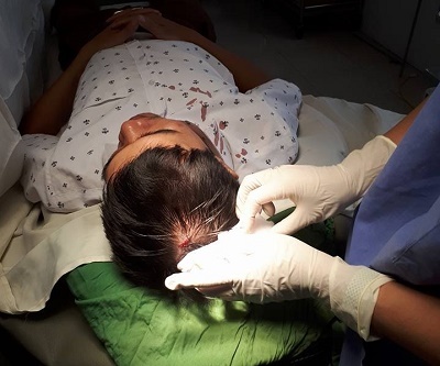 Truy tìm kẻ lạ mặt tấn công bác sỹ bằng máy đo huyết áp