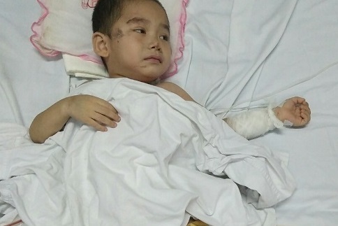 Cậu bé mất 2 chân sau vụ sạt lở đất ở Sơn La: