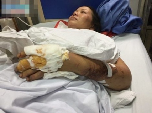 Dập nát hết tay chân, người mẹ vẫn cố bới đất đá cứu con bị chôn vùi dưới đống đổ nát