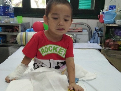 Tin mới nhất về cháu bé mất 2 chân trong vụ sạt lở ở Sơn La