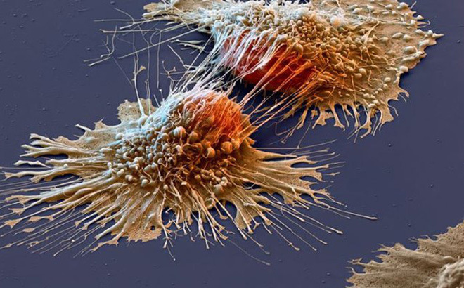 TS nổi tiếng Mỹ tiết lộ 6 “chiến binh