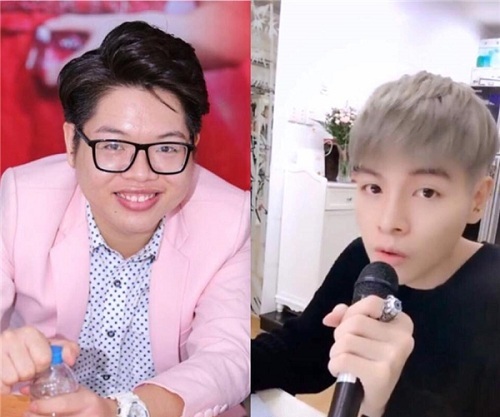 Các bác sĩ đã làm thế nào để chữa miệng cười hở lợi cho Đức Phúc?