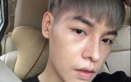 Đức Phúc phải làm lại giấy tờ tùy thân sau khi phẫu thuật thẩm mỹ