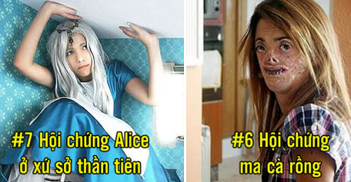 Những căn bệnh kỳ quái mà khoa học vẫn chưa thể lý giải được