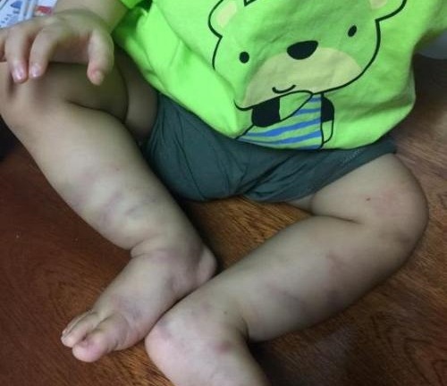 Cảnh sát vào cuộc vụ bé trai 1 tuổi nghi bị bạo hành, bỏ rơi ở bệnh viện