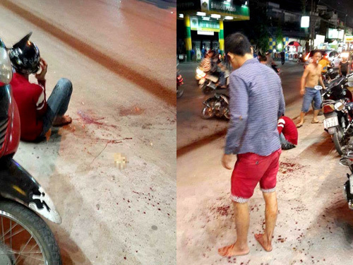 Bắt kẻ chém lìa bàn tay nam thanh niên ở quán game