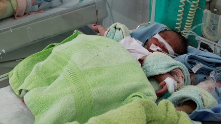 Phát hiện bé gái sinh non bị bỏ rơi trong túi nylon