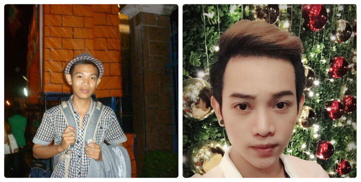 Sau 8 lần sửa mũi, chàng trai có ngoại hình khiêm tốn kiếm được nhiều tiền